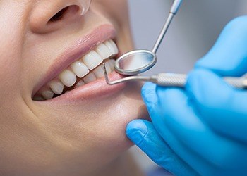 Closeup of smile during dental treatment