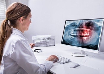 Digital dental x-rays on computer screen