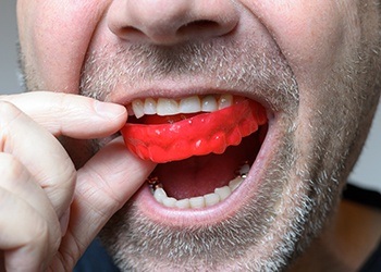 Man placing athletic mouthguard